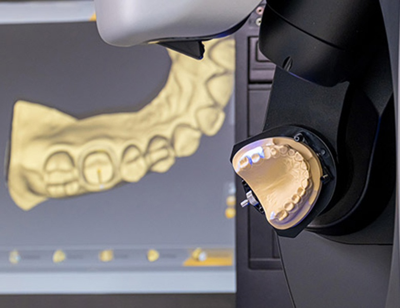 インターパーク（宇都宮・雀宮）の歯医者、こうだい歯科のCAD/CAMシステム