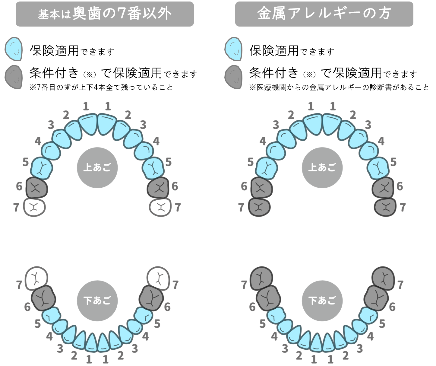 保険診療でも白い歯に - こうだい歯科｜宇都宮（雀宮）の歯医者なら、こうだい歯科まで