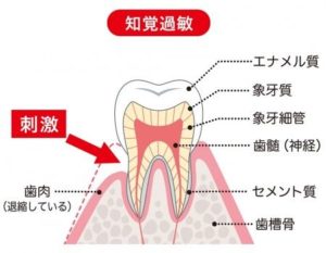 宇都宮市の歯医者、こうだい歯科