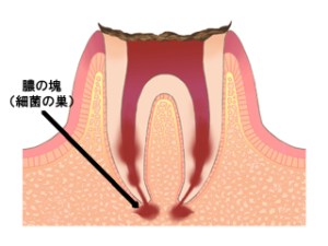 宇都宮の歯医者、こうだい歯科