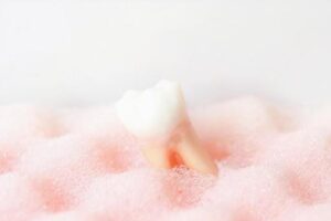 宇都宮市(雀宮、上三川町)の歯医者、こうだい歯科で乳歯の虫歯について解説