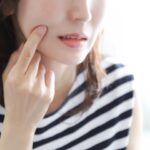 宇都宮市(雀宮、上三川町)の歯医者、こうだい歯科で口の端が切れやすい原因について解説