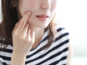 宇都宮市(雀宮、上三川町)の歯医者、こうだい歯科で口の端が切れやすい原因について解説