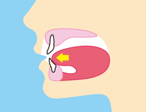 宇都宮市(雀宮、上三川町)のこうだい歯科で舌を噛む癖が歯並びに与える影響を解説