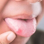 宇都宮市(雀宮、上三川町)のこうだい歯科で舌を噛む癖が歯並びに与える影響を解説